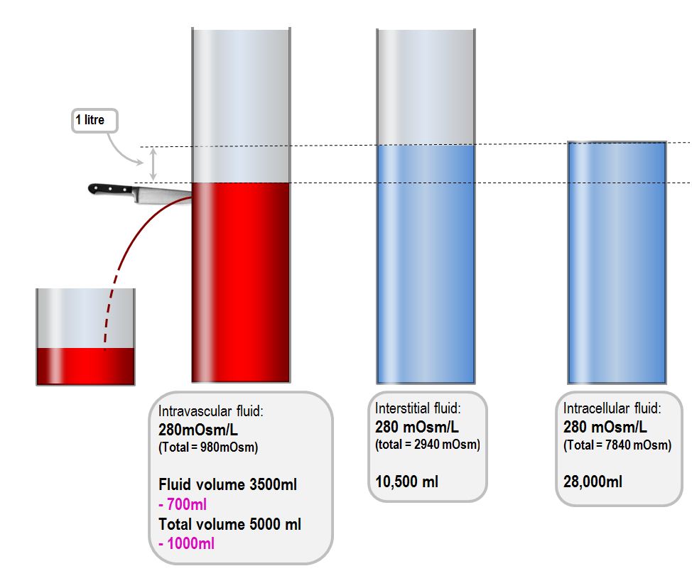 Response to haemorrhage the loss of 1L of blood Deranged Physiology